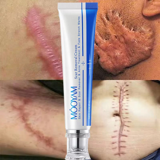 MOOYAM ANTI CICATRICE